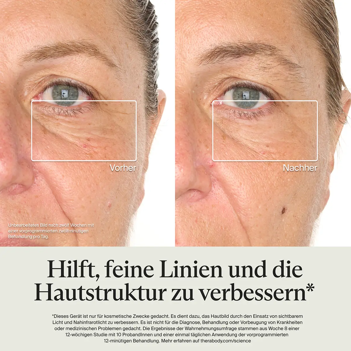 TheraFace Mask Glo LED Maske zur Hautverjüngung - Image 4